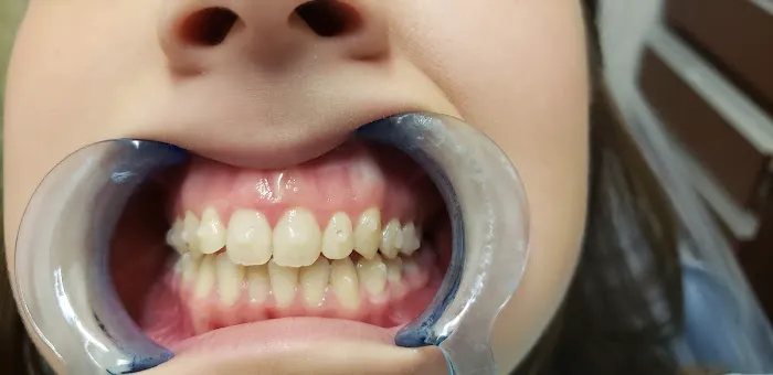 Dr Harsimran Chadha DDS Picture 1