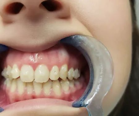 Dr Harsimran Chadha DDS