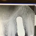Bio Dental - Shawn Matian DDS