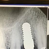 Bio Dental - Shawn Matian DDS ico