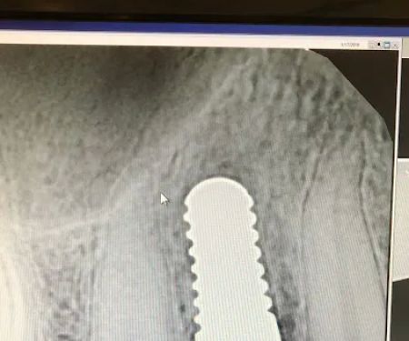 Bio Dental - Shawn Matian DDS