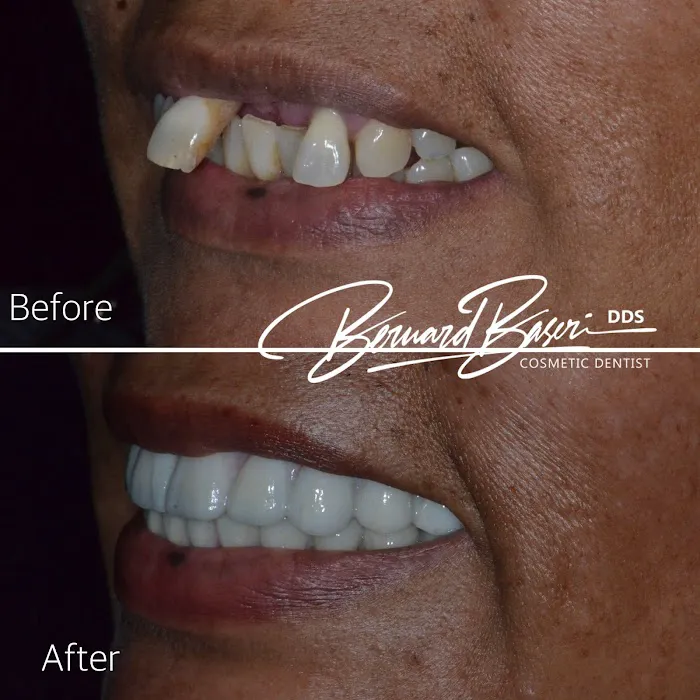 Smile Recreation Dentistry Picture 2
