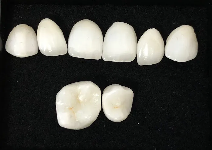Smile Recreation Dentistry Picture 7
