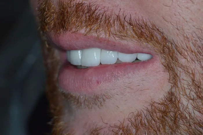 Smile Recreation Dentistry Picture 9