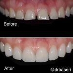 Smile Recreation Dentistry