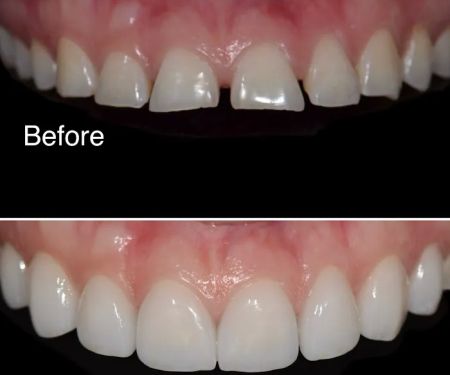 Smile Recreation Dentistry