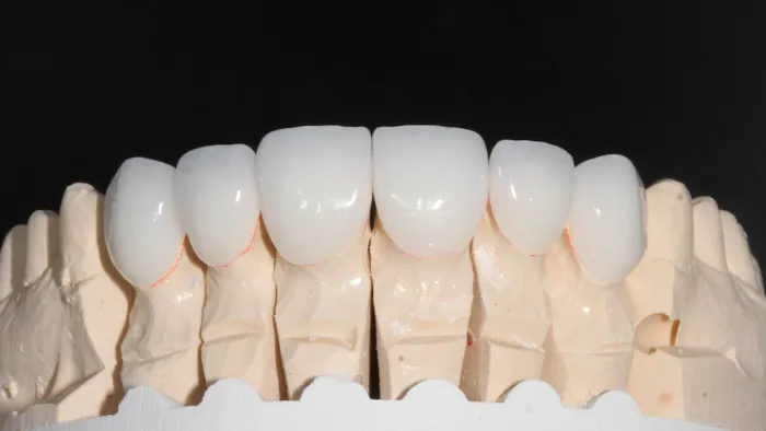 Beverly Hills Emergency Dentist Picture 6