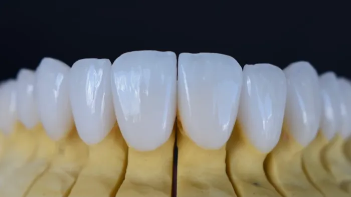 Beverly Hills Emergency Dentist Picture 4