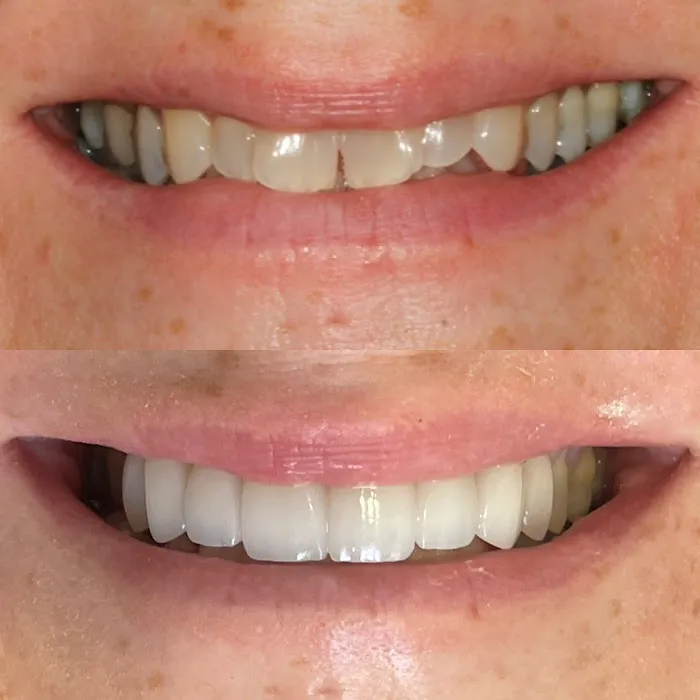 Beverly Hills Emergency Dentist Picture 5