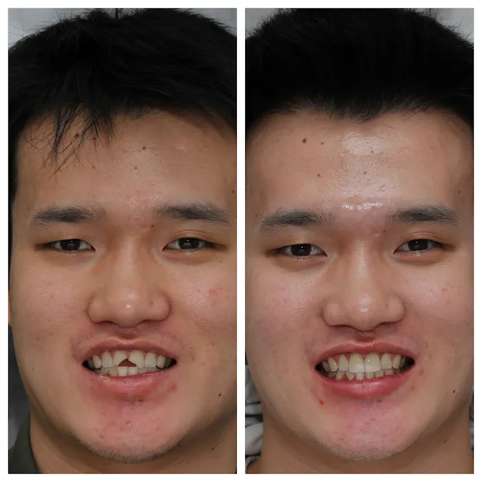 Beverly Hills Emergency Dentist Picture 8