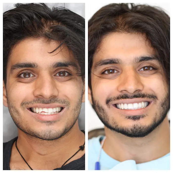 Beverly Hills Emergency Dentist Picture 9