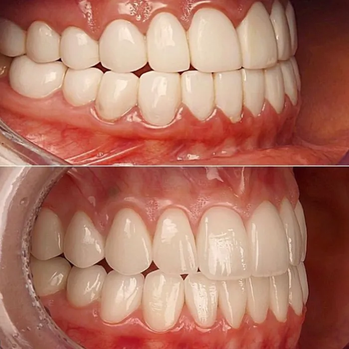 Beverly Hills Emergency Dentist Picture 10