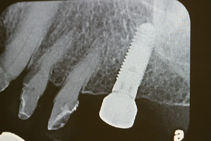 Los Angeles Dentists Group - Glendale Picture 6