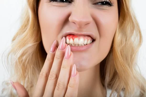 What to Do If You Have a Swollen Gum – Effective Remedies and Tips