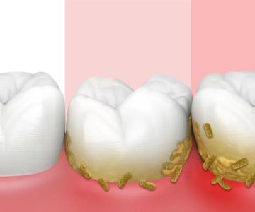 How to Avoid Gum Disease with Proper Oral Care
