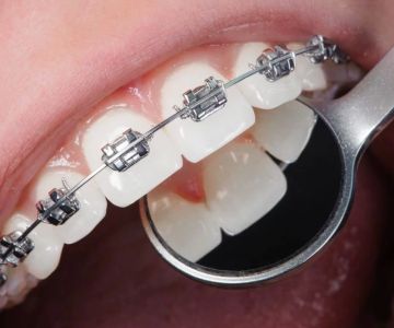 How to Manage Your Dental Care During Orthodontic Treatment: Essential Tips for Healthy Teeth