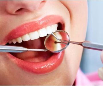 Benefits of Dental Bonding: A Comprehensive Guide to Tooth Bonding Procedure