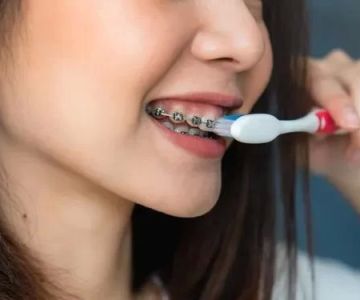 Dental Care for People with Braces: Essential Tips for Maintaining Oral Health