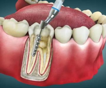 How to Prevent Bad Breath and Improve Your Oral Health