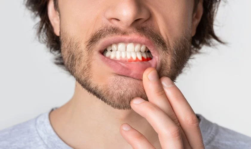 How to Treat a Tooth Infection at Home Safely and Effectively