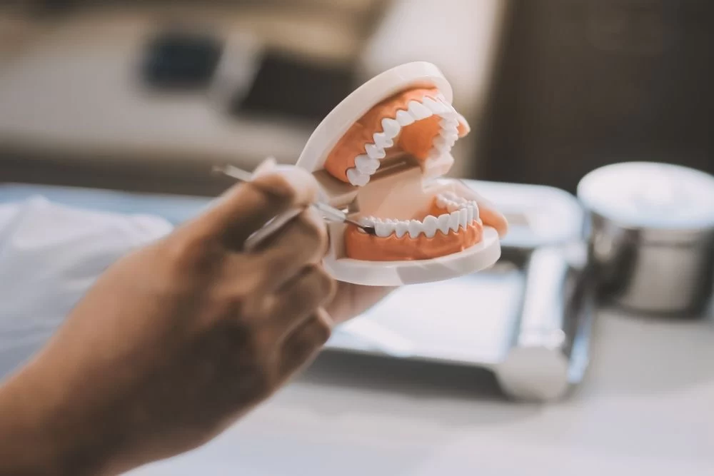 Best Practices for Cleaning and Caring for Dental Bridges: Essential Tips