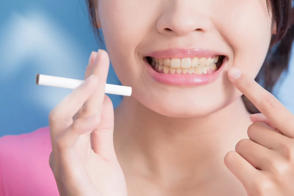 Effective Methods on How to Fix Black Spots on Teeth for a Brighter Smile