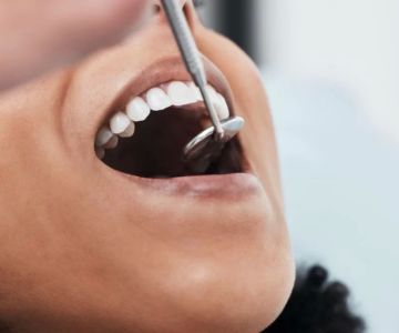 How to Fix Uneven Gums Naturally: Practical Tips and Effective Remedies