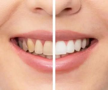 Choosing the Best Toothpaste for Sensitive Teeth and Gums: A Detailed Guide