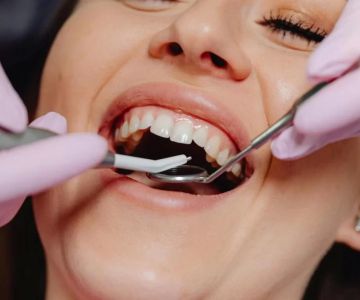 Recognizing the Signs of Gum Infection Early for Better Oral Health