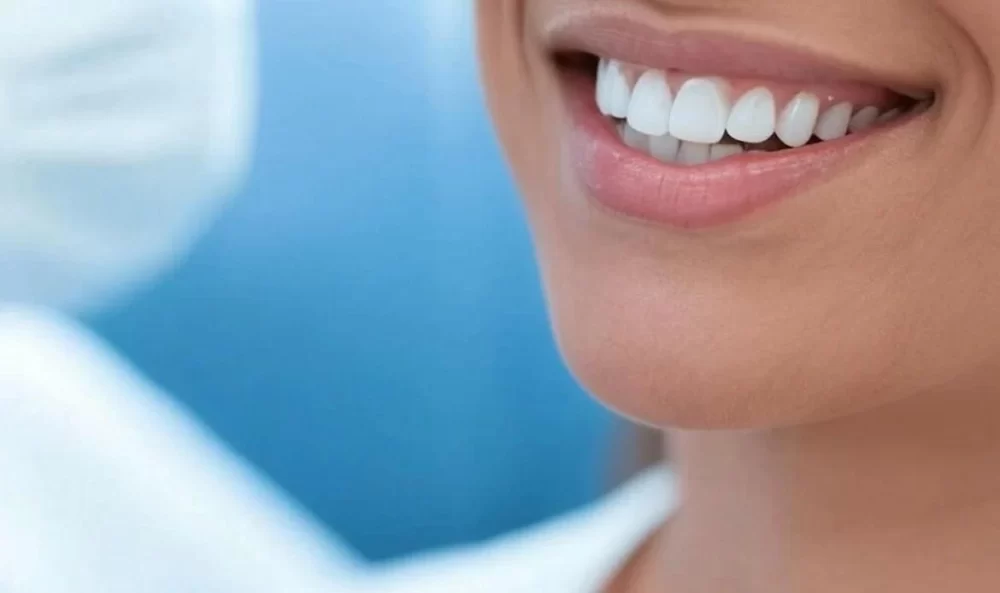How to Whiten Teeth with Professional Whitening Kits Safely and Effectively