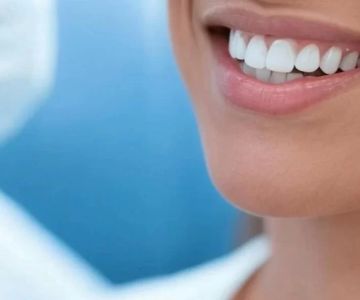 How to Whiten Teeth with Professional Whitening Kits Safely and Effectively