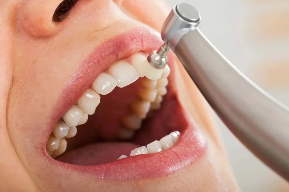 Exploring the Benefits of Regular Dental Cleanings for Lasting Oral Health