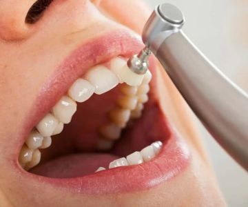 Exploring the Benefits of Regular Dental Cleanings for Lasting Oral Health