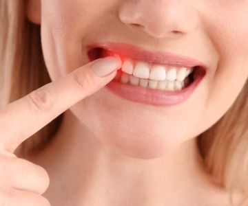 How to Prevent Gum Bleeding After Dental Cleaning and Surgery Care