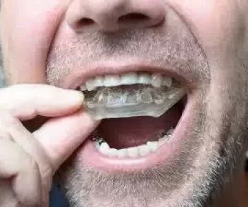 Effective Ways to Prevent Teeth Grinding at Night and Protect Your Smile